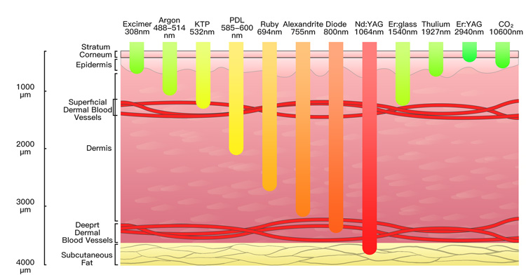 veterinary therapy laser