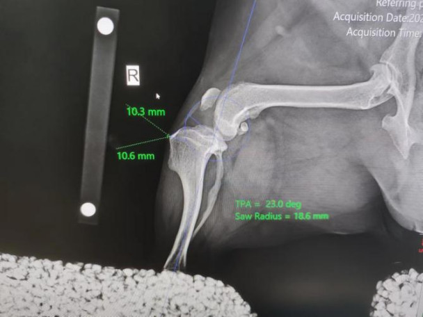 tibial plateau level orthosis, laser physical therapy