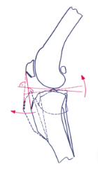 tibial plateau level orthosis, laser physical therapy