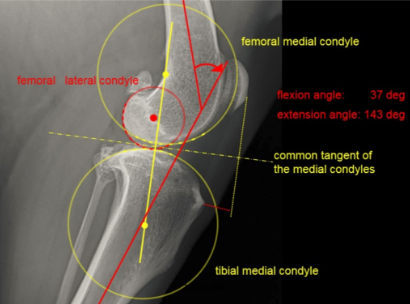 tibial plateau level orthosis, laser physical therapy