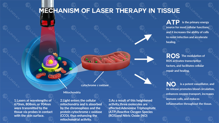 What Is the Photobiomodulation(PBM) ?