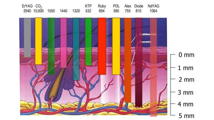 Laser Clinical Treatment with Different Energy Intensity