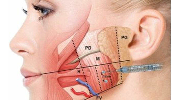 Using Low Level Laser Therapy (LLLT) to Repair and Reduce the Pain of TMJ