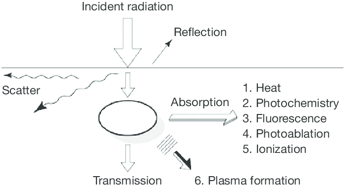 The Principle of Laser Tissue Interactions in Dental Treatment